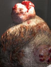 Figure 1. Tumeur nodulaire du cuir chevelu (HFM) 