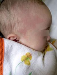 Figure 1. Photo de Hannaé envoyée par les parents.